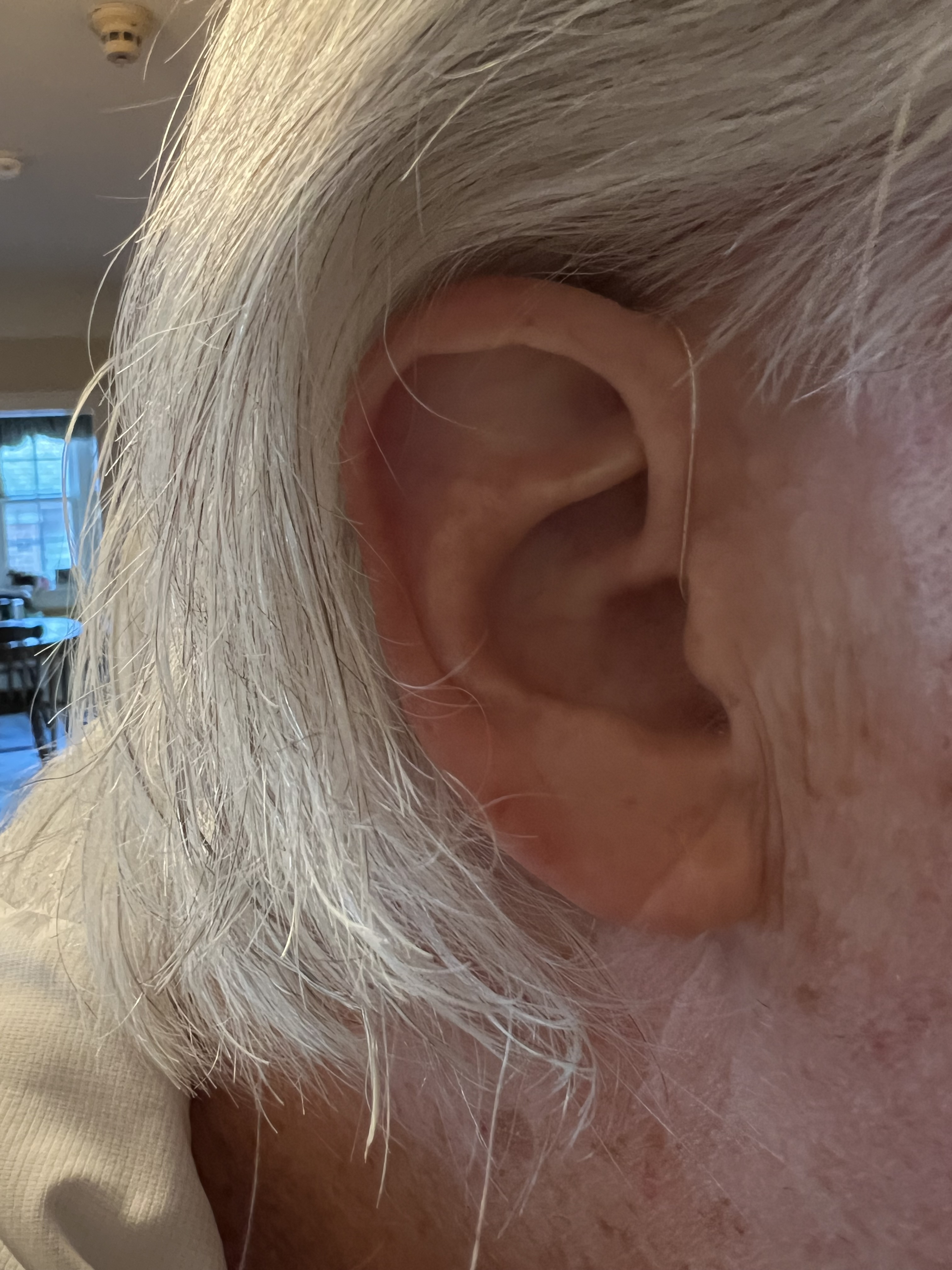 a closeup of my ear with a tiny wire going into it